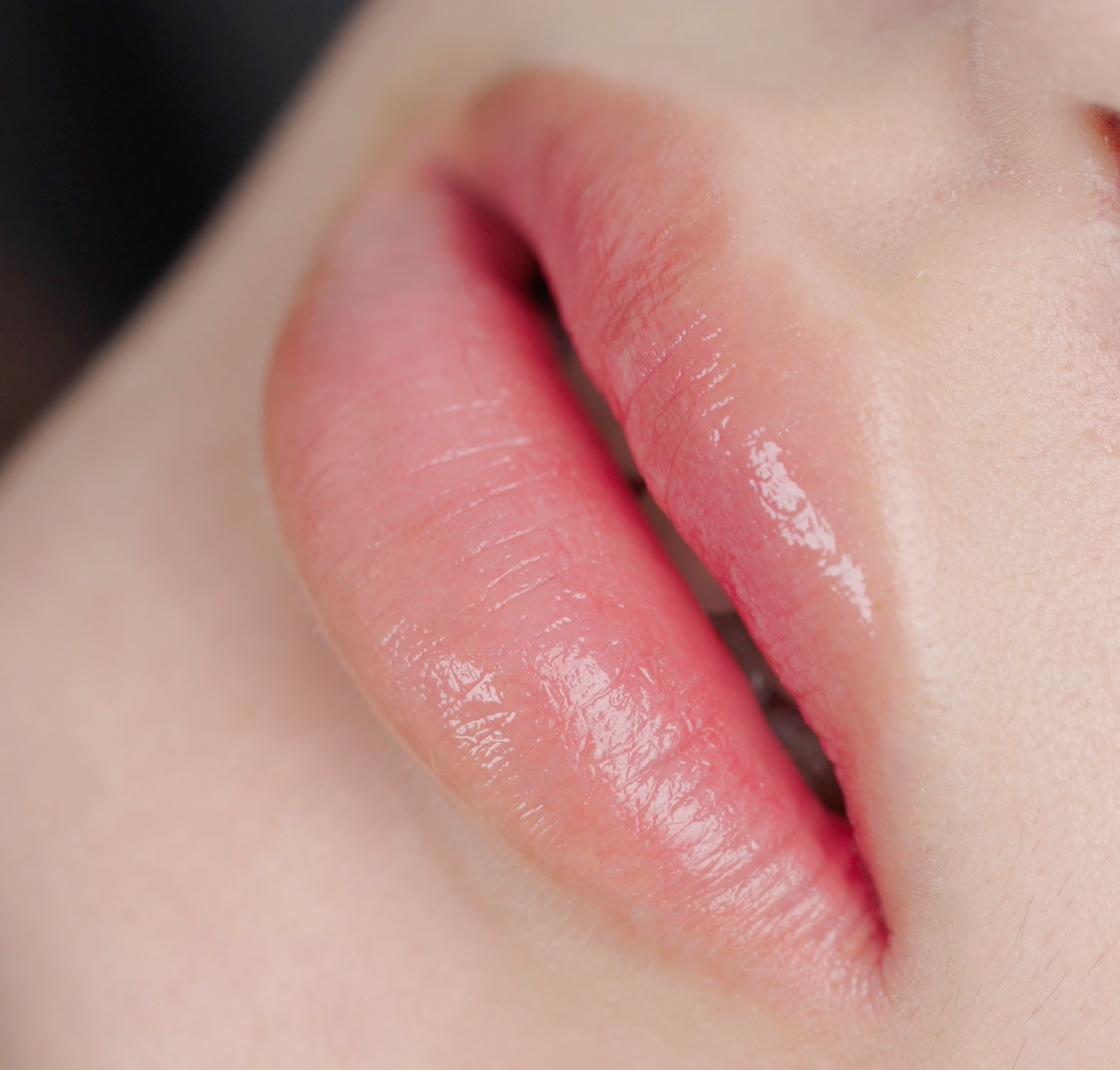lips