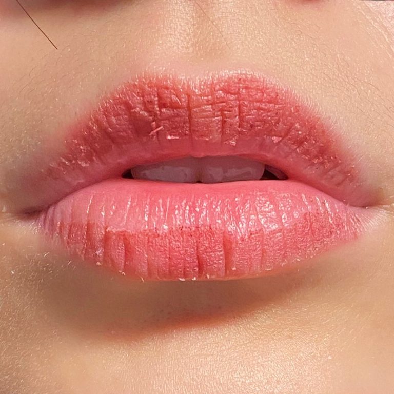 Blog phục hồi